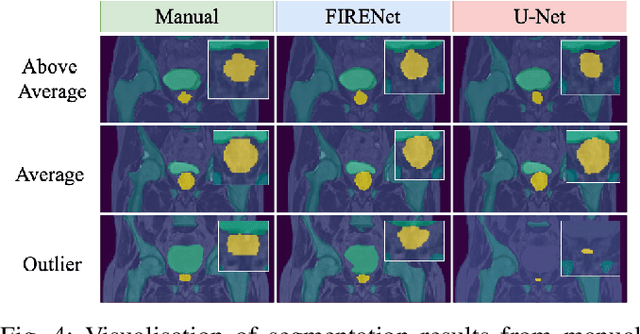 Figure 4 for Fabric Image Representation Encoding Networks for Large-scale 3D Medical Image Analysis