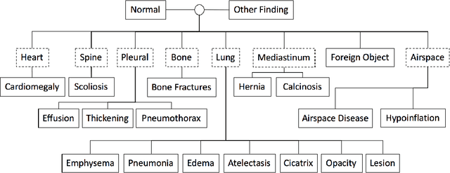 Figure 1 for When Radiology Report Generation Meets Knowledge Graph