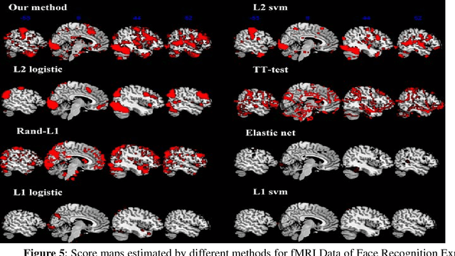 Figure 4 for A Novel Approach for Stable Selection of Informative Redundant Features from High Dimensional fMRI Data