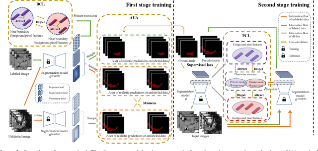 Figure 2 for Exploring Feature Representation Learning for Semi-supervised Medical Image Segmentation