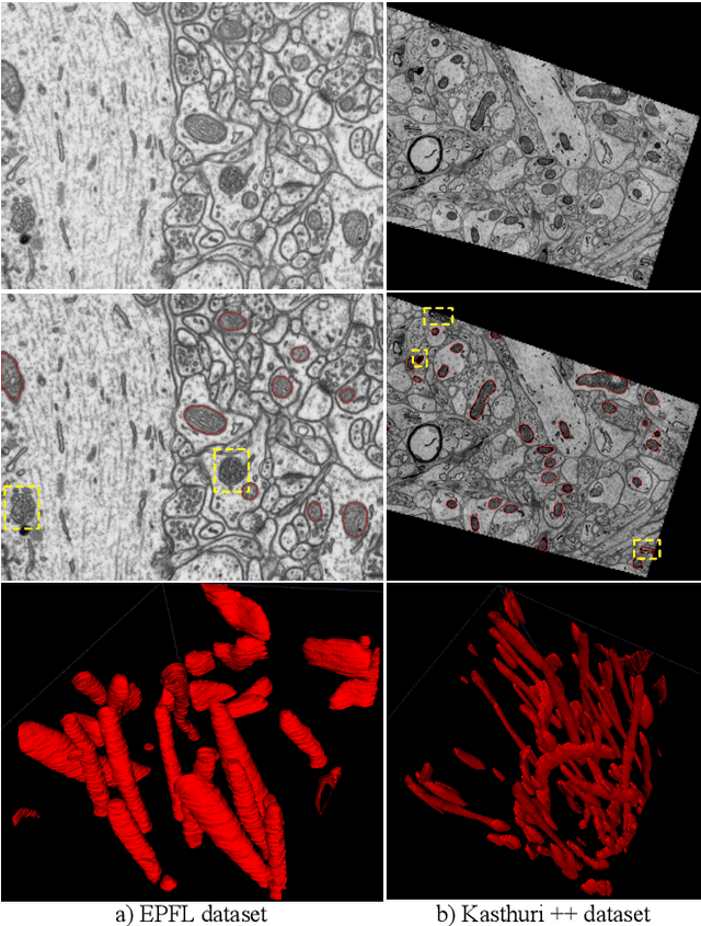 Figure 1 for HIVE-Net: Centerline-Aware HIerarchical View-Ensemble Convolutional Network for Mitochondria Segmentation in EM Images