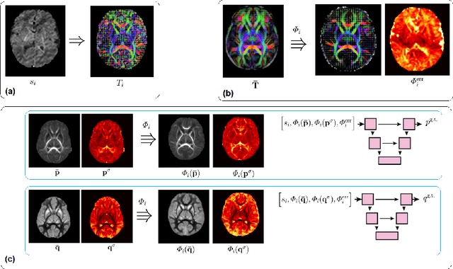 Figure 3 for Atlas-powered deep learning (ADL) -- application to diffusion weighted MRI