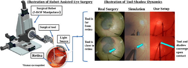 Figure 1 for Towards Autonomous Eye Surgery by Combining Deep Imitation Learning with Optimal Control