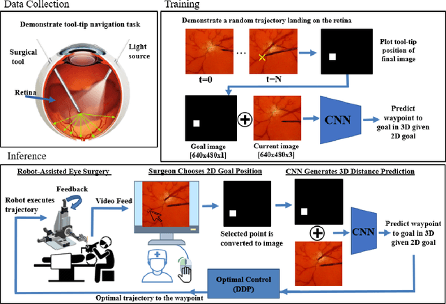 Figure 3 for Towards Autonomous Eye Surgery by Combining Deep Imitation Learning with Optimal Control