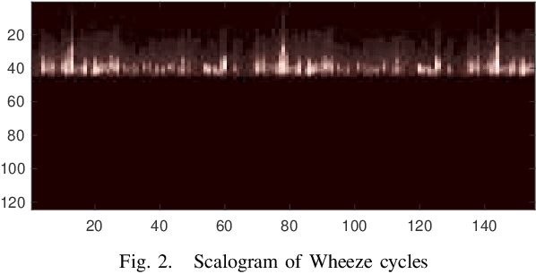 Figure 2 for Inception-Based Network and Multi-Spectrogram Ensemble Applied For Predicting Respiratory Anomalies and Lung Diseases
