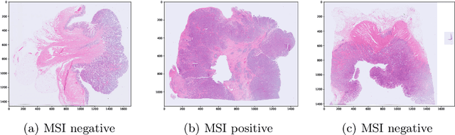 Figure 4 for End-to-end Learning for Image-based Detection of Molecular Alterations in Digital Pathology