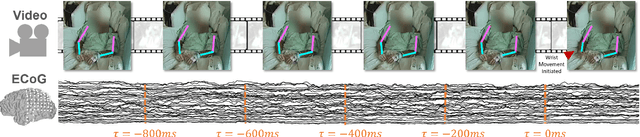 Figure 1 for AJILE Movement Prediction: Multimodal Deep Learning for Natural Human Neural Recordings and Video
