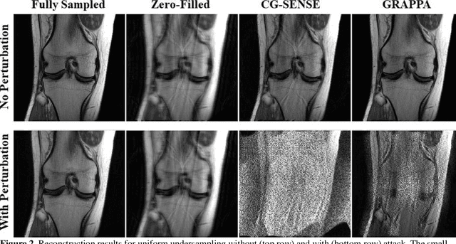 Figure 2 for On Instabilities of Conventional Multi-Coil MRI Reconstruction to Small Adverserial Perturbations