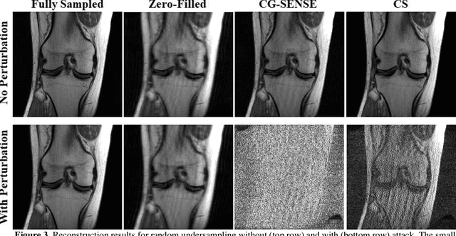 Figure 3 for On Instabilities of Conventional Multi-Coil MRI Reconstruction to Small Adverserial Perturbations