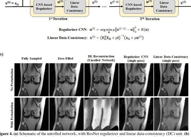 Figure 4 for On Instabilities of Conventional Multi-Coil MRI Reconstruction to Small Adverserial Perturbations