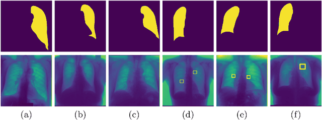 Figure 3 for Efficient Active Learning for Image Classification and Segmentation using a Sample Selection and Conditional Generative Adversarial Network