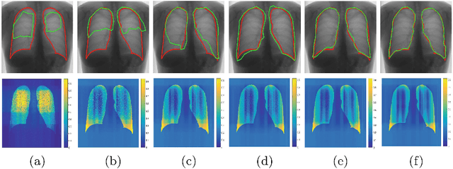 Figure 4 for Efficient Active Learning for Image Classification and Segmentation using a Sample Selection and Conditional Generative Adversarial Network