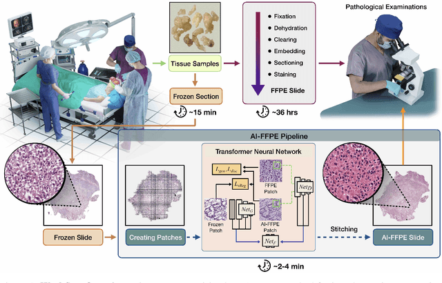 Figure 1 for Deep Learning-based Frozen Section to FFPE Translation