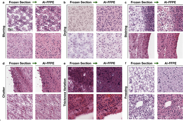 Figure 3 for Deep Learning-based Frozen Section to FFPE Translation