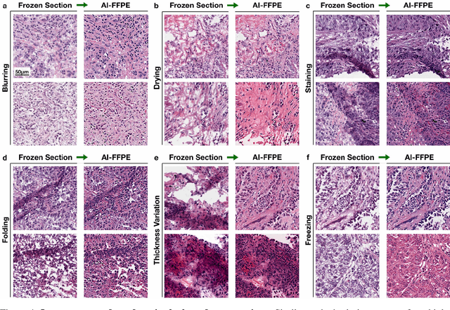 Figure 4 for Deep Learning-based Frozen Section to FFPE Translation