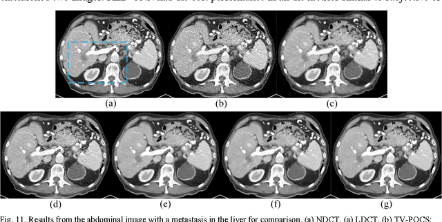 Figure 2 for Low-Dose CT with a Residual Encoder-Decoder Convolutional Neural Network