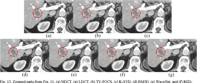 Figure 3 for Low-Dose CT with a Residual Encoder-Decoder Convolutional Neural Network