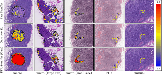 Figure 4 for PFA-ScanNet: Pyramidal Feature Aggregation with Synergistic Learning for Breast Cancer Metastasis Analysis