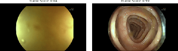 Figure 4 for Motion-Based Weak Supervision for Video Parsing with Application to Colonoscopy