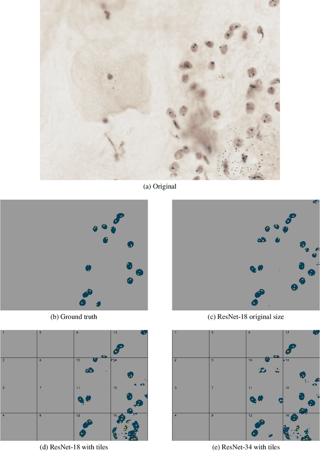 Figure 2 for Comparative analysis of deep learning approaches for AgNOR-stained cytology samples interpretation