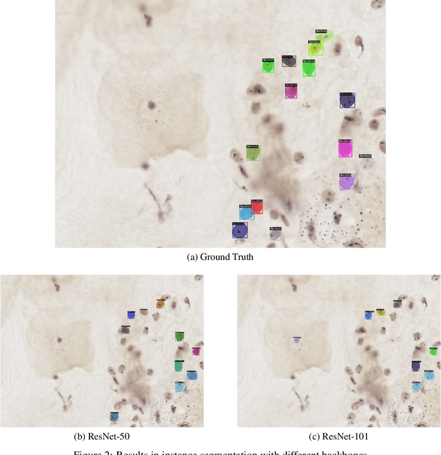 Figure 3 for Comparative analysis of deep learning approaches for AgNOR-stained cytology samples interpretation