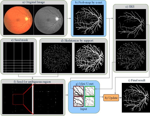 Figure 1 for Dynamic Deep Networks for Retinal Vessel Segmentation