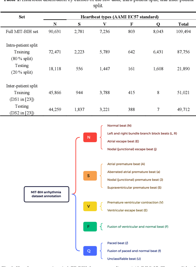 Figure 2 for ECG Heartbeat classification using deep transfer learning with Convolutional Neural Network and STFT technique