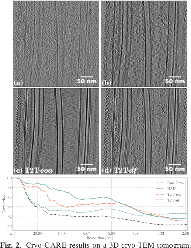 Figure 2 for Cryo-CARE: Content-Aware Image Restoration for Cryo-Transmission Electron Microscopy Data