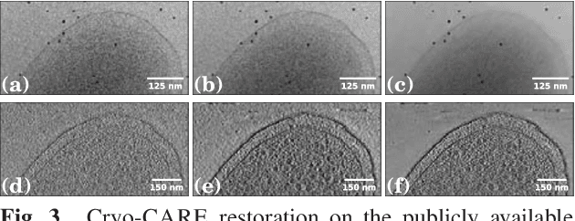 Figure 3 for Cryo-CARE: Content-Aware Image Restoration for Cryo-Transmission Electron Microscopy Data