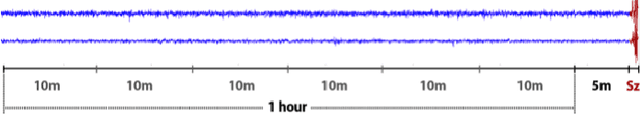 Figure 1 for Human Intracranial EEG Quantitative Analysis and Automatic Feature Learning for Epileptic Seizure Prediction