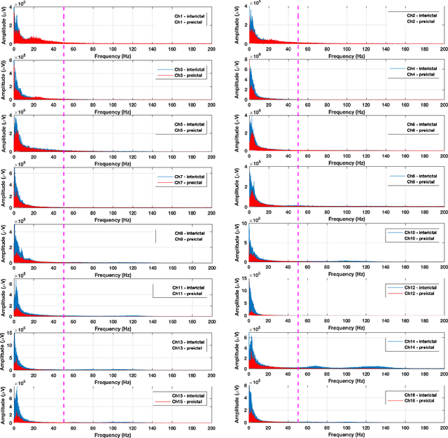 Figure 3 for Human Intracranial EEG Quantitative Analysis and Automatic Feature Learning for Epileptic Seizure Prediction