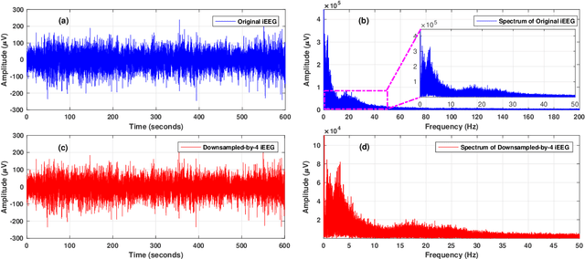 Figure 4 for Human Intracranial EEG Quantitative Analysis and Automatic Feature Learning for Epileptic Seizure Prediction