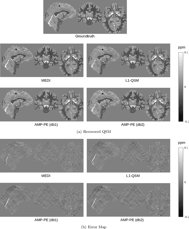 Figure 4 for Robust Quantitative Susceptibility Mapping via Approximate Message Passing