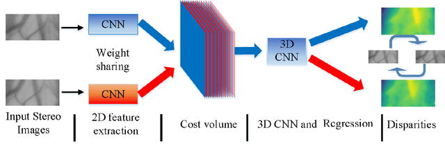Figure 1 for Non-destructive three-dimensional measurement of hand vein based on self-supervised network