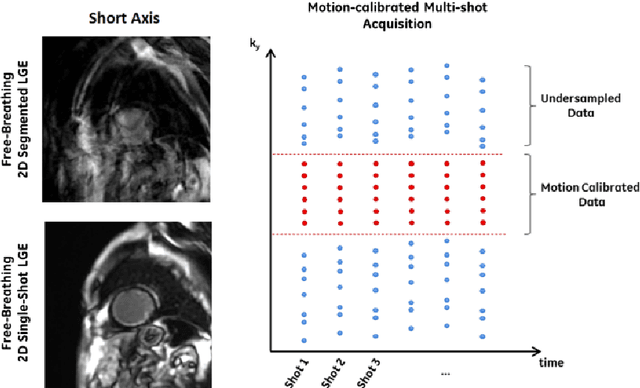 Figure 1 for Motion Estimated-Compensated Reconstruction with Preserved-Features in Free-Breathing Cardiac MRI