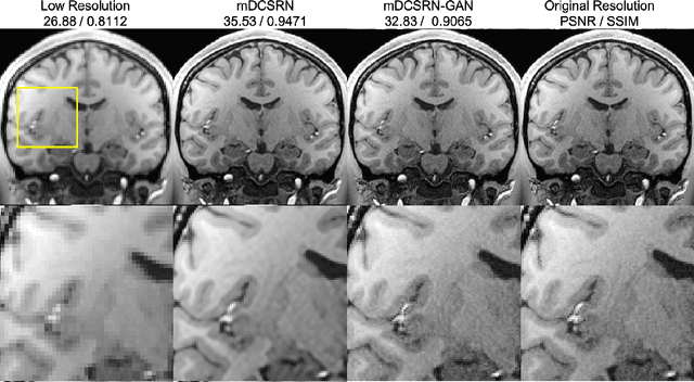 Figure 1 for MRI Super-Resolution with GAN and 3D Multi-Level DenseNet: Smaller, Faster, and Better