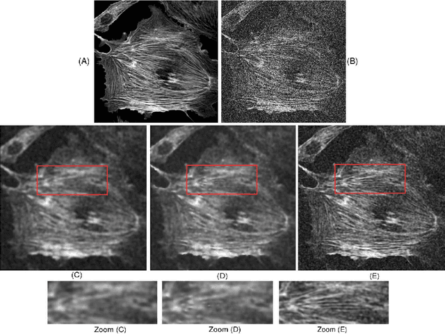 Figure 3 for Fast space-variant elliptical filtering using box splines