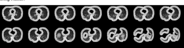 Figure 4 for COVID-VIT: Classification of COVID-19 from CT chest images based on vision transformer models