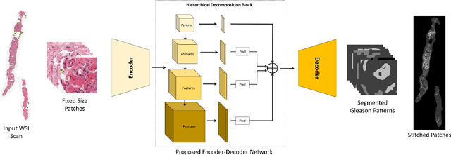 Figure 3 for Autonomous Extraction of Gleason Patterns for Grading Prostate Cancer using Multi-Gigapixel Whole Slide Images
