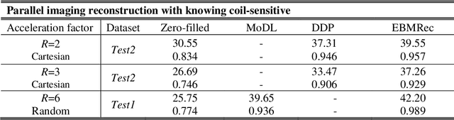 Figure 4 for MRI Reconstruction Using Deep Energy-Based Model