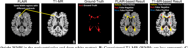 Figure 1 for Multi-Domain Learning by Meta-Learning: Taking Optimal Steps in Multi-Domain Loss Landscapes by Inner-Loop Learning