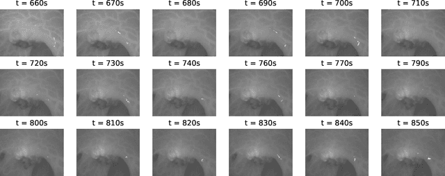 Figure 3 for Perfusion Quantification from Endoscopic Videos: Learning to Read Tumor Signatures