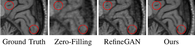 Figure 1 for Converged Deep Framework Assembling Principled Modules for CS-MRI