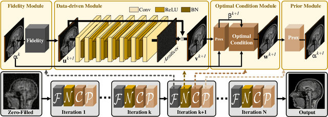 Figure 4 for Converged Deep Framework Assembling Principled Modules for CS-MRI