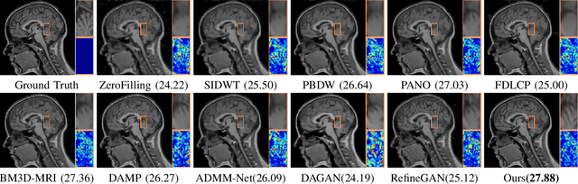 Figure 2 for Converged Deep Framework Assembling Principled Modules for CS-MRI