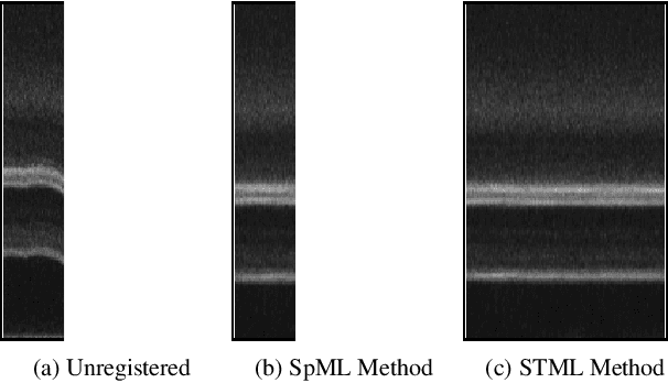 Figure 4 for Accelerating the Registration of Image Sequences by Spatio-temporal Multilevel Strategies