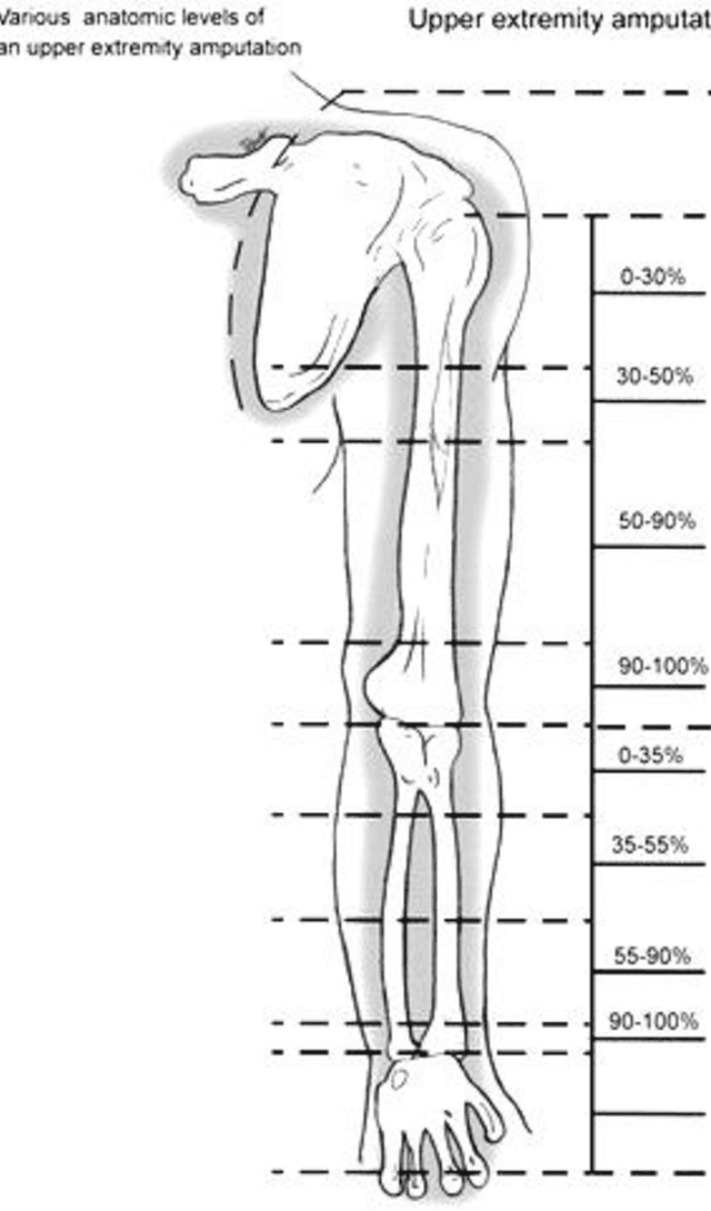 Figure 1 for Automation of Prosthetic Upper Limbs for Transhumeral Amputees Using Switch-controlled Motors