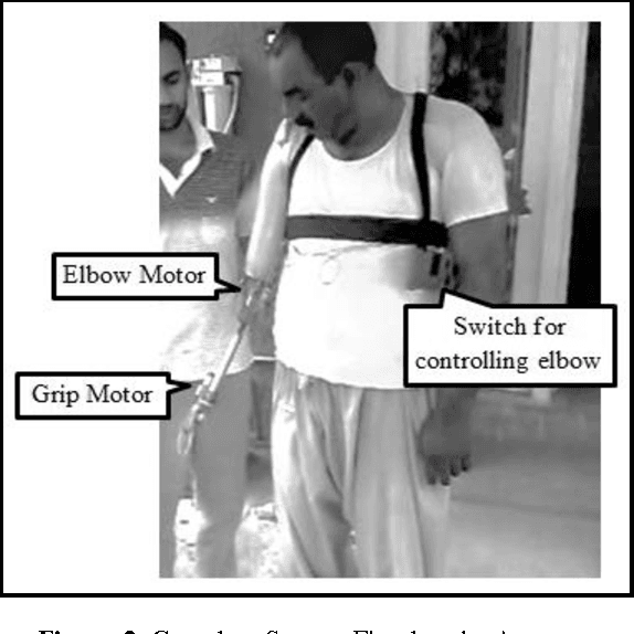 Figure 3 for Automation of Prosthetic Upper Limbs for Transhumeral Amputees Using Switch-controlled Motors