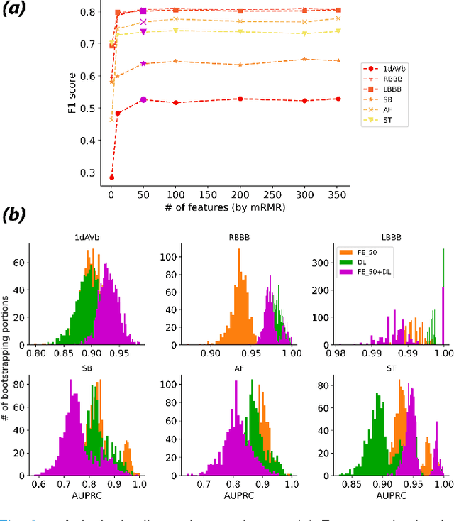 Figure 2 for On Merging Feature Engineering and Deep Learning for Diagnosis, Risk-Prediction and Age Estimation Based on the 12-Lead ECG