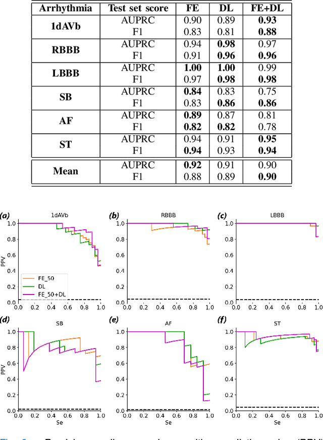 Figure 3 for On Merging Feature Engineering and Deep Learning for Diagnosis, Risk-Prediction and Age Estimation Based on the 12-Lead ECG